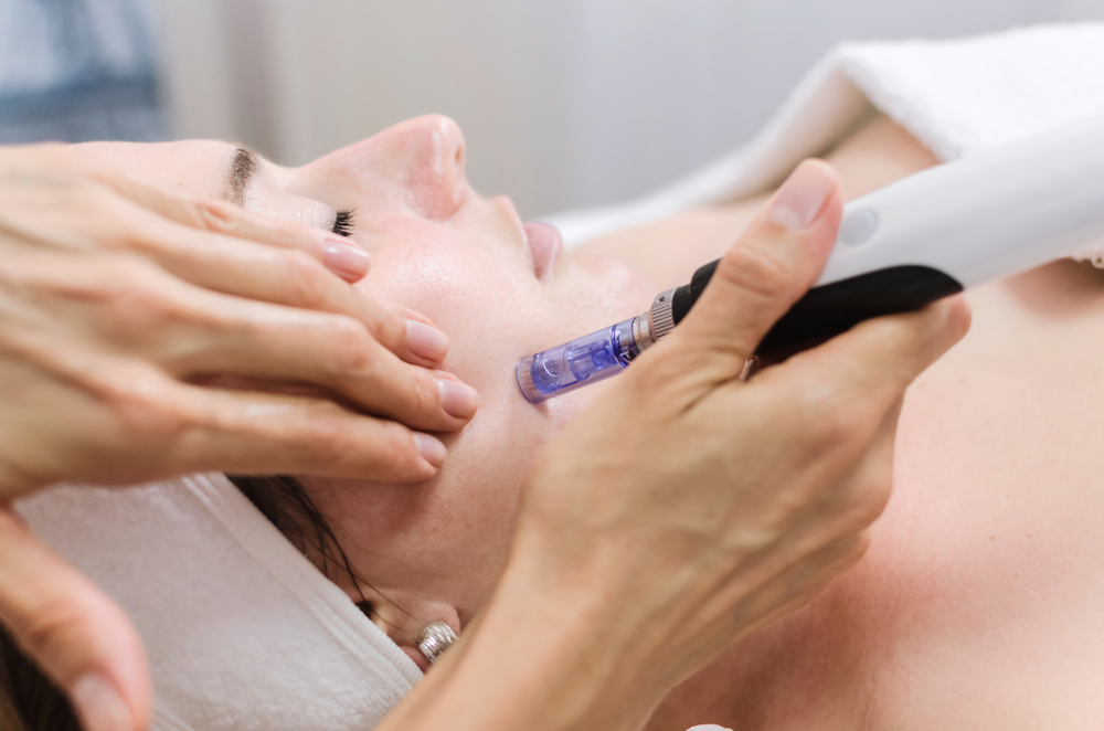 Microneedling Facial Aesthetics Treatments